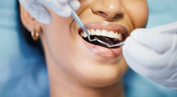 Best Emergency Denture Repair in St Hedwig, TX