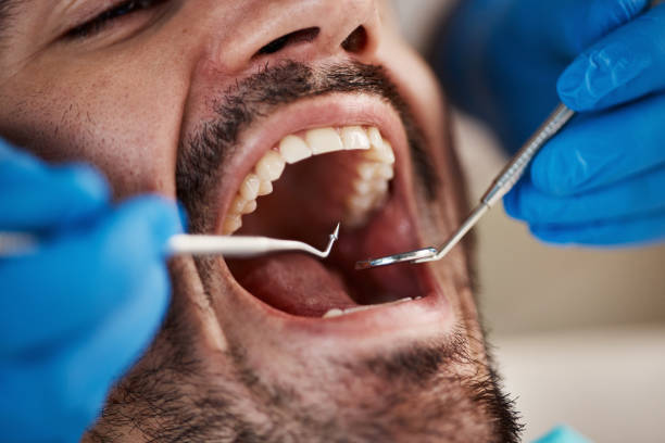 Best Emergency Care for Gum Disease in St Hedwig, TX