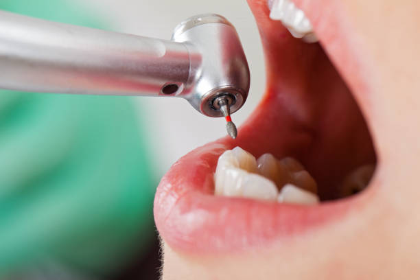 Best Emergency Root Canal Therapy in St Hedwig, TX